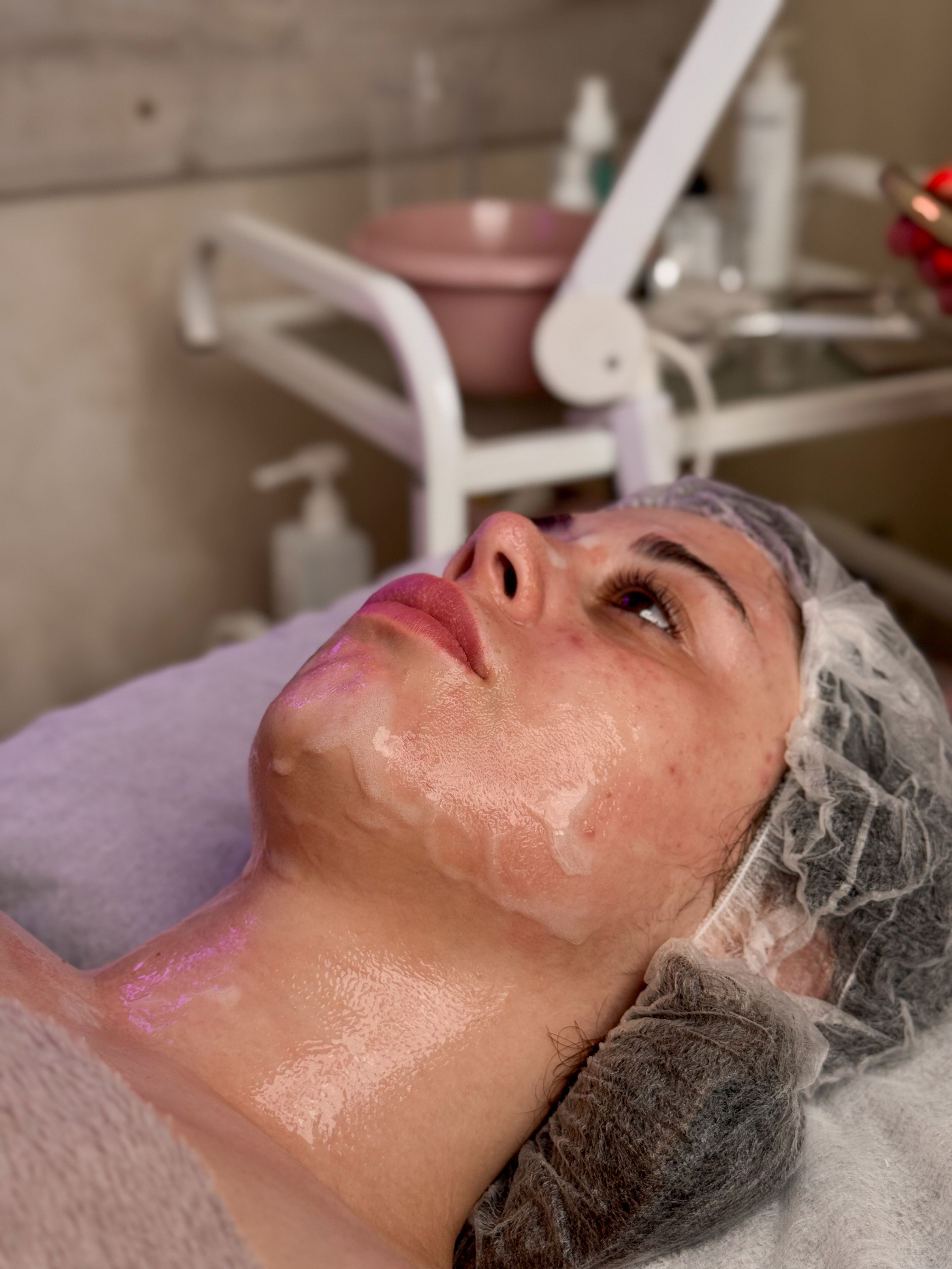 Карбокситерапія (60 хв)